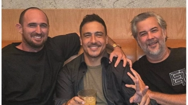 7 Fakta Menarik Hamish Daud: Setengah Wajah dari Besi, Pernah Koma