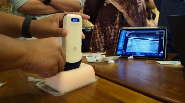 Sakit dan Trauma Akibat Infus Gagal? USG Jadi Solusi Aman Akses Pembuluh Darah!