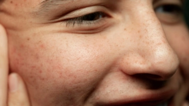 3 Sunscreen untuk Mencegah Hiperpigmentasi bagi Wanita Usia 40-an