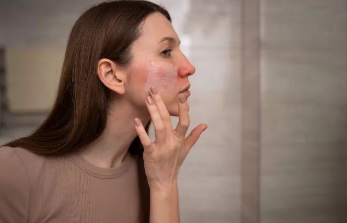 Tips Jaga Kulit Sehat, Lakukan Rutinitas Ini Tiap Hari!