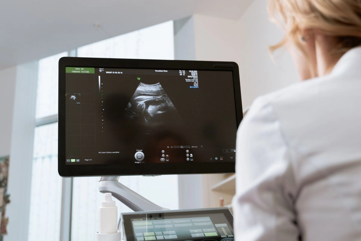 HPV DNA Self-sampling, Cara Nyaman Deteksi Dini Kanker Serviks