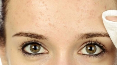 5 Rekomendasi Moisturizer dengan AHA BHA untuk Kulit Bruntusan, Bantu Kulit Lebih Halus