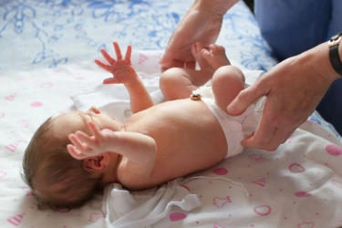 Benjolan pada Anak Tidak Selalu Hernia, Ketahui Perbedaannya