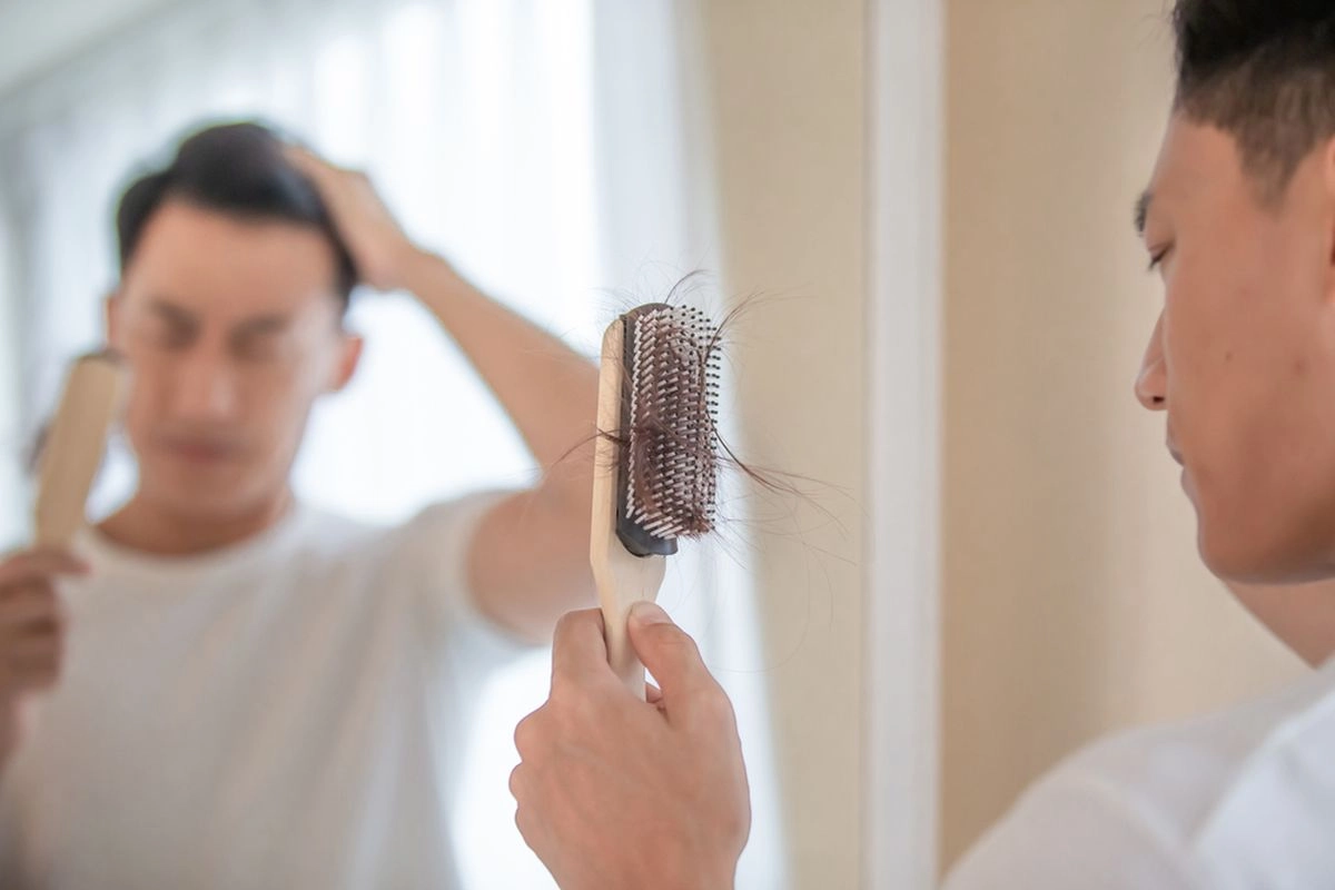 Perawatan Rambut Rontok di Korea Selatan Diusulkan Ditanggung Asuransi