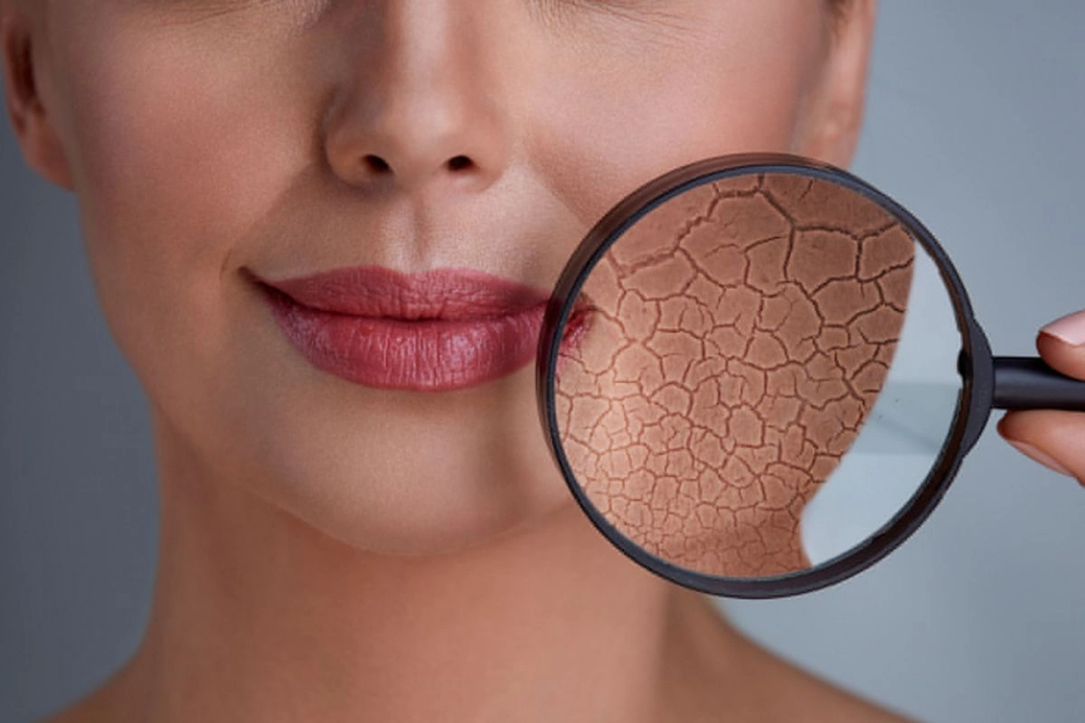 Tanda Penuaan di Wajah yang Sering Terlewat dan Hal yang Mempercepat