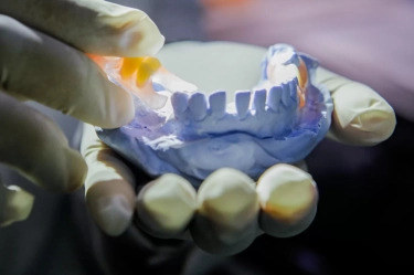 Mengenal Penyebab dan Cara Mengatasi Agar Gigi Tidak Ompong pada Orang Dewasa