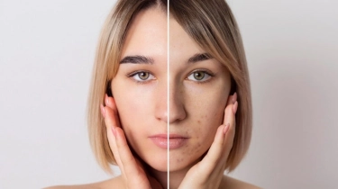 Apa Sunscreen Wardah untuk Flek Hitam? Ini 4 Pilihan Terbaik untuk Lindungi Wajah