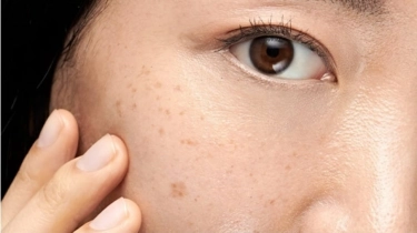 Apakah Flek Hitam Usia 40 Tahun Bisa Hilang? Ini 5 Retinol Paling Efektif