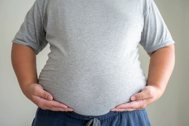 Ilmuwan Usulkan Cara Baru Menilai Obesitas, Tak Lagi Bertumpu pada BMI