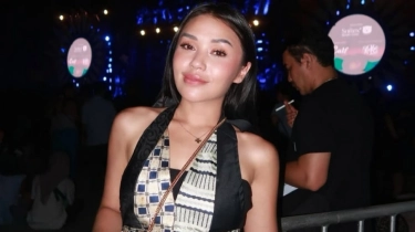 Terpopuler: Riwayat Sakit Lula Lahfah, Fakta Menarik Manusia Silver yang Jadi Model