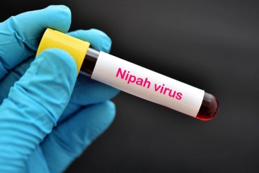 Apa Itu Virus Nipah? Penyakit Menular Berbahaya Mirip Flu yang Belum Punya Vaksin