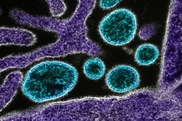 Kasus Virus Nipah Bertambah, Thailand Awasi Ketat Pendatang dari India