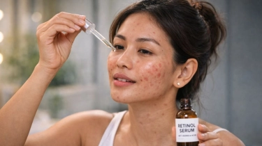 Kalau Lagi Jerawatan, Apakah Boleh Pakai Retinol? Begini Tips Amannya