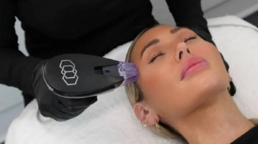 Kulit Kencang Tanpa Bedah? Bongkar Cara Kerja Morpheus8 Brust untuk Dagu hingga Paha!