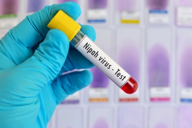 WHO Ungkap Temuan Virus Nipah di India, Dua Perawat Terinfeksi dan Satu Masih Kritis