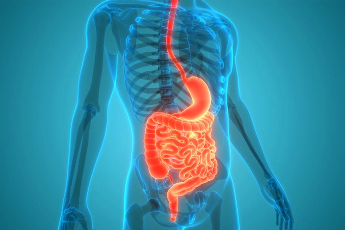 2 Masalah Pencernaan Paling Sering Dikeluhkan Masyarakat Perkotaan