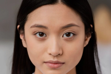 7 Cara Mengatasi Kantung Mata Hitam dengan Aman dan Efektif