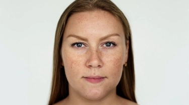 Mandelic Acid vs Lactic Acid, Mana yang Lebih Aman untuk Lansia Hilangkan Flek Hitam?