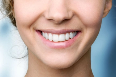 Aligner Transparan jadi Pilihan Populer Merapikan Gigi Tanpa Kawat