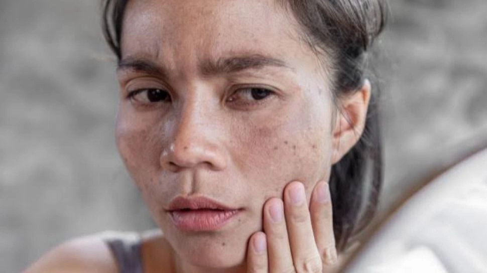 4 Skincare Lacoco untuk Hempaskan Noda Hitam, Brand Lokal Rasa Premium