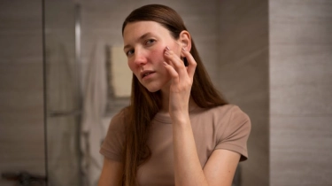 4 Sunscreen yang Sebaiknya Dihindari Kulit Sensitif, Cegah Kemerahan dan Iritasi