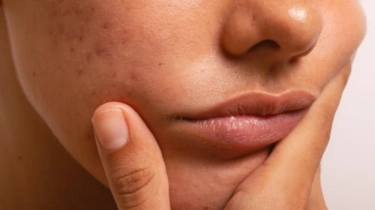 5 Moisturizer Alternatif Cerave untuk Atasi Skin Barrier Rusak, Kulit OTW Mulus Kembali