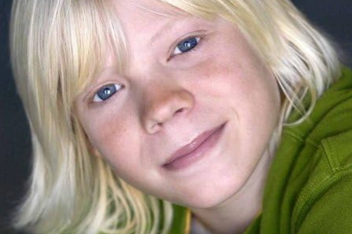 Blake Garrett Meninggal Dunia Setelah Sempat Alami Herpes Zoster, Ini Penjelasan Medisnya