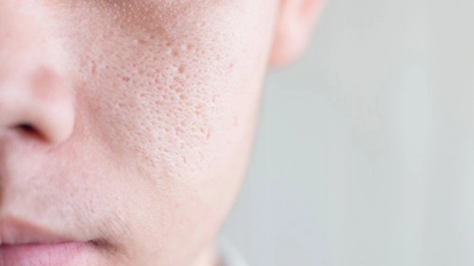 Gimana Biar Pori-Pori Wajah Mengecil? Ini 5 Langkah Skincare yang Perlu Dilakukan