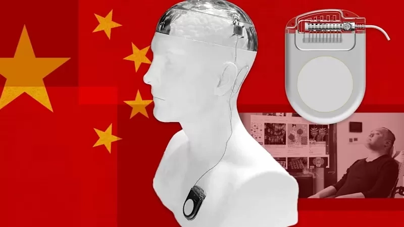 Tiongkok Dorong Industri Implan Otak sebagai Sektor Strategis untuk Menyaingi Neuralink Elon Musk