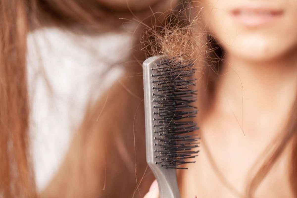 Obat Penurun Berat Badan Sebabkan Rambut Rontok? Ini Kata Ahli