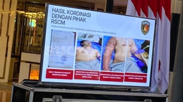 'Sudah Sampai di Situ', Polda Metro Jaya Tegaskan Tak Lagi Usut Kasus Air Keras Aktivis KontraS