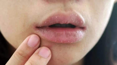 Apakah Ada Sunscreen untuk Bibir? Ini Penjelasan dan Rekomendasi Lip Balm SPF Terbaik
