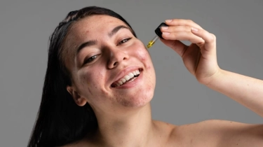 Gimana Cara Mengatasi Jerawat ketika Haid? 5 Skincare Salicylic Acid Ini Patut Dicoba