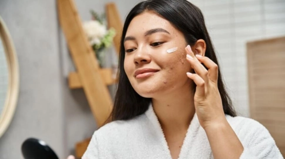 Milia di Wajah Bisa Hilang? Ini 7 Skincare yang Bisa Dicoba Biar Halus dan Glowing
