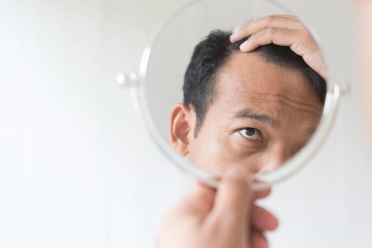 Peptide Bisa Atasi Penipisan Rambut? Kenali Manfaat dan Jenisnya