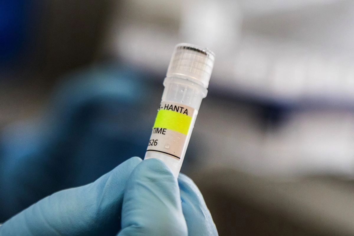 Belajar dari Covid-19, Pengawasan Bandara Diperketat demi Cegah Penyebaran Hantavirus