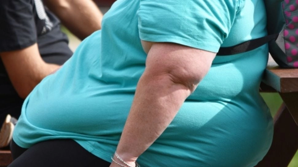 Obesitas Tak Lagi Sekadar Masalah Berat Badan, Kapan Perlu Bedah Bariatrik?