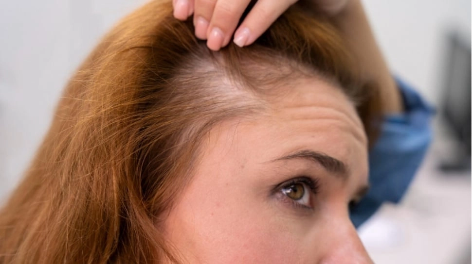 Banyak Ibu Mengalaminya, Ini Kisah Bangkit dari Kerontokan Rambut Pascapersalinan